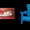 Teeth_v_Lawnchair